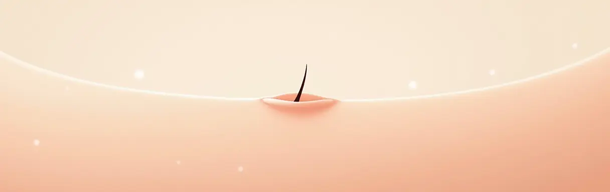 Как избавиться от вросших волос после эпиляции